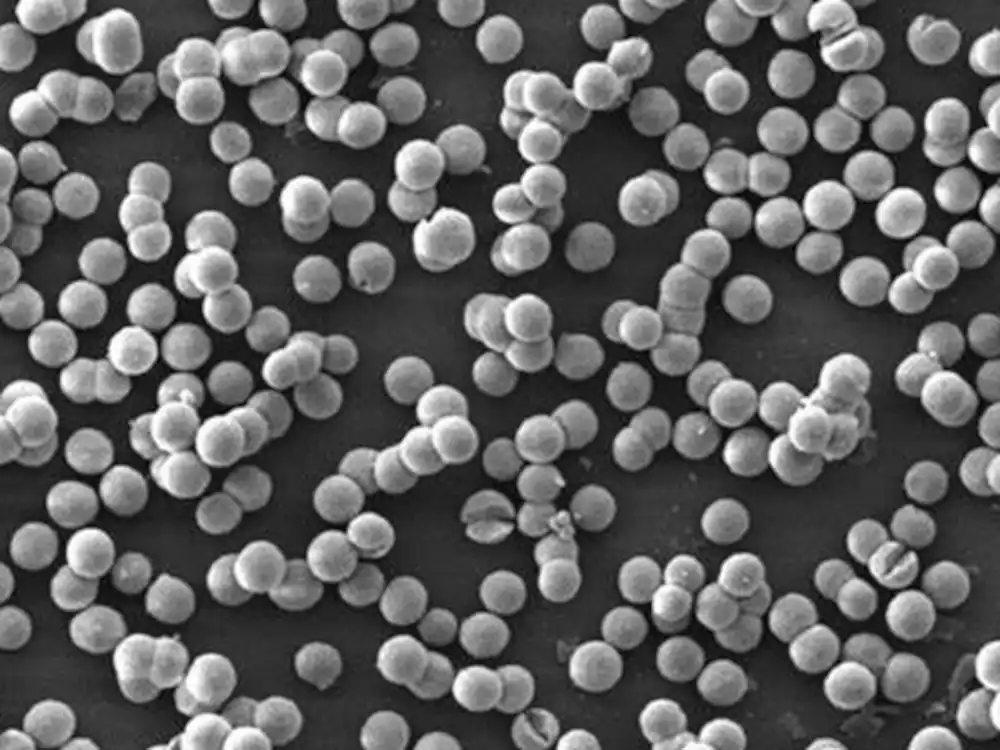 spherical magnesium oxide