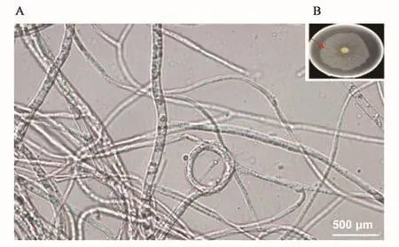 Morphological characteristics of the pathogen